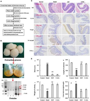 Immunomodulatory Activities of a Fungal Protein Extracted from Hericium erinaceus through Regulating the Gut Microbiota